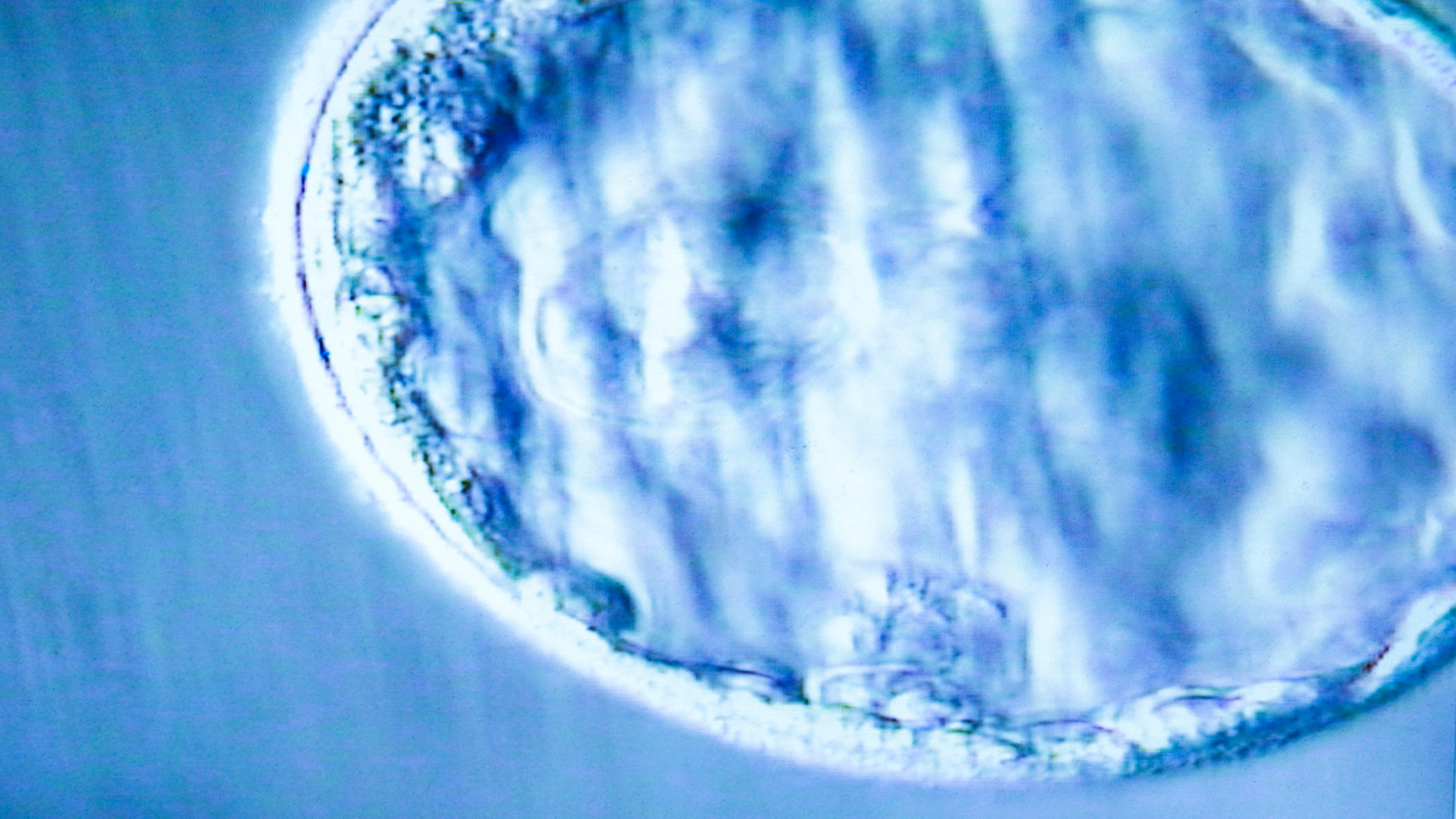 embrion, blastocisto